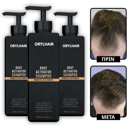 Orylo™ RootBoost Σαμπουάν Αναζωογόνησης Μαλλιών