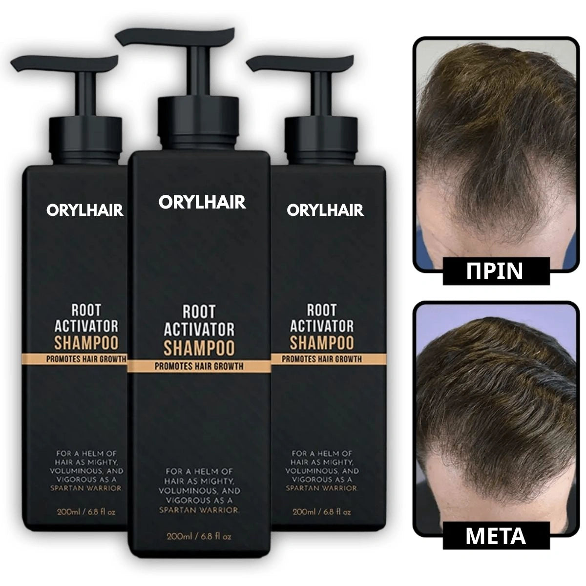 Orylo™ RootBoost Σαμπουάν Αναζωογόνησης Μαλλιών v2