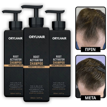 Orylo™ RootBoost Σαμπουάν Αναζωογόνησης Μαλλιών v2