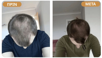 Orylo™ RootBoost Σαμπουάν Αναζωογόνησης Μαλλιών