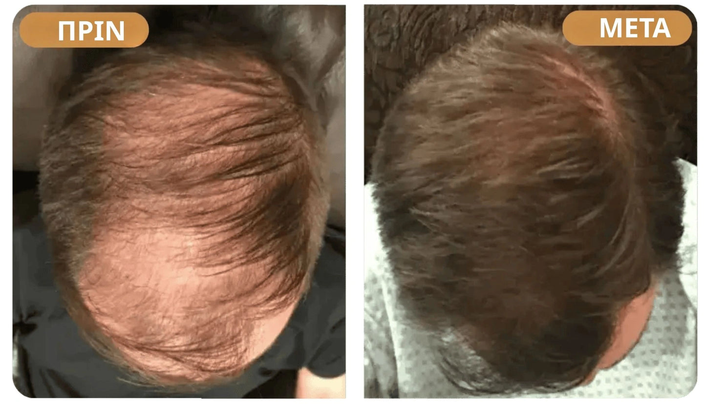 Orylo™ RootBoost Σαμπουάν Αναζωογόνησης Μαλλιών