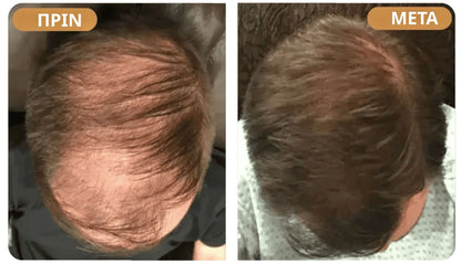 Orylo™ RootBoost Σαμπουάν Αναζωογόνησης Μαλλιών