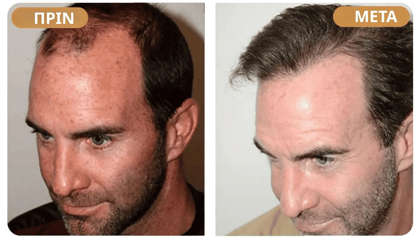 Orylo™ RootBoost Σαμπουάν Αναζωογόνησης Μαλλιών