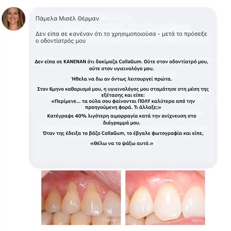 Collagen Powder for Gums