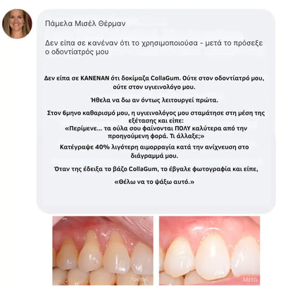 Collagen Powder for Gums