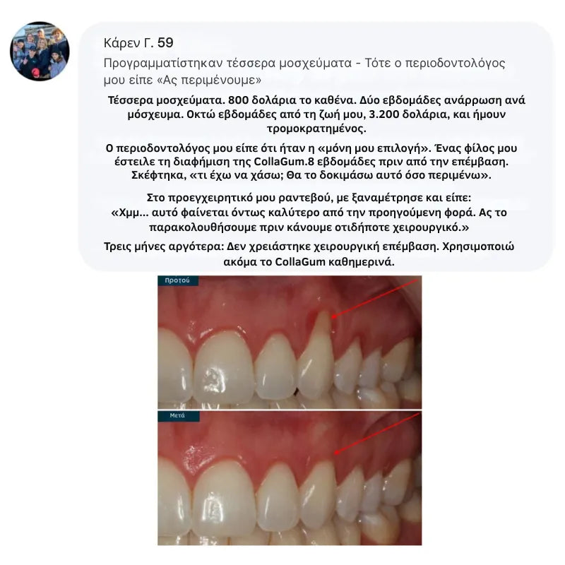 Collagen Powder for Gums