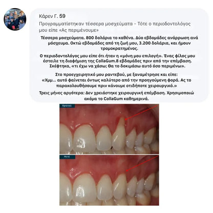 Collagen Powder for Gums