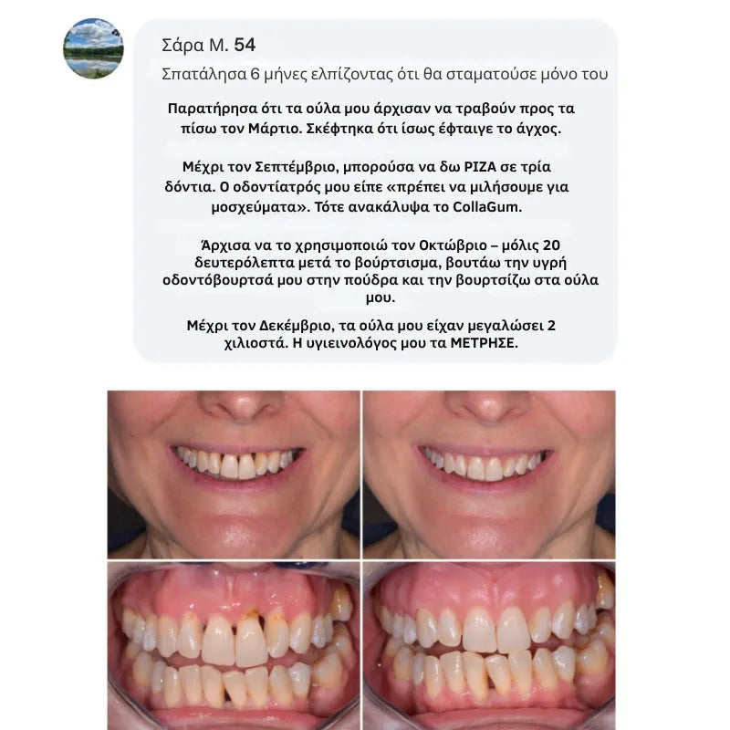 Collagen Powder for Gums