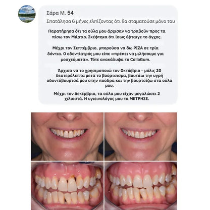 Collagen Powder for Gums