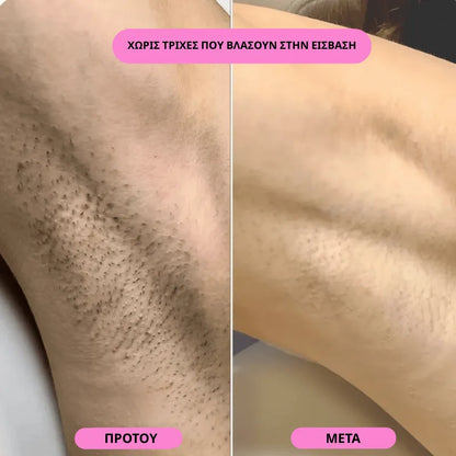 Women's Razor
