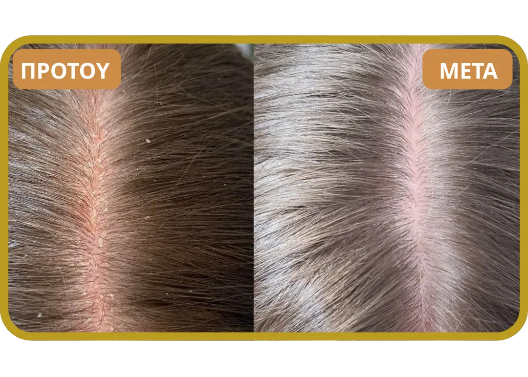 Orylo™ RootBoost Σαμπουάν Αναζωογόνησης Μαλλιών v2 (Women)
