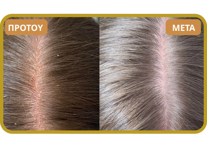 Orylo™ RootBoost Σαμπουάν Αναζωογόνησης Μαλλιών v2 (Women)
