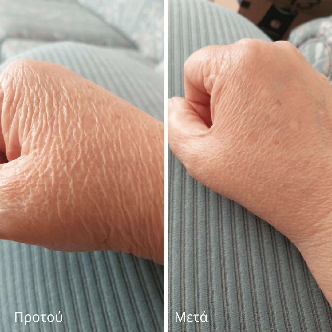 Novaderm™ | Κρέμα Επιδιόρθωσης Δέρματος