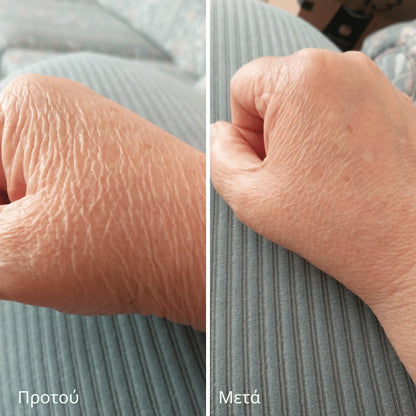 Novaderm™ | Κρέμα Επιδιόρθωσης Δέρματος