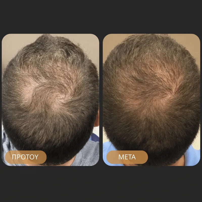 Orylo™ RootBoost Σαμπουάν Αναζωογόνησης Μαλλιών