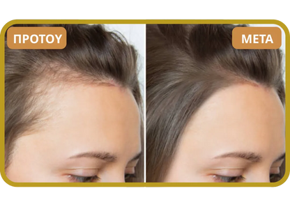 Orylo™ RootBoost Σαμπουάν Αναζωογόνησης Μαλλιών v2 (Women)