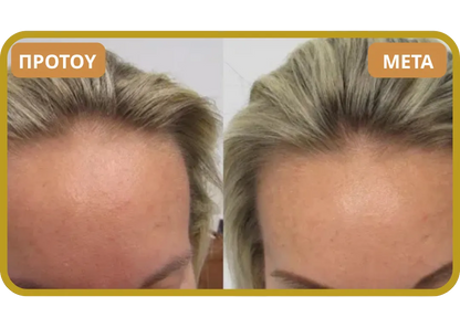 Orylo™ RootBoost Σαμπουάν Αναζωογόνησης Μαλλιών v2 (Women)
