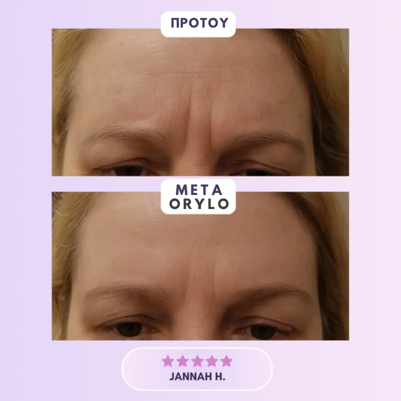Collagen Scar Tape