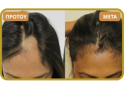 Orylo™ RootBoost Σαμπουάν Αναζωογόνησης Μαλλιών v2 (Women)