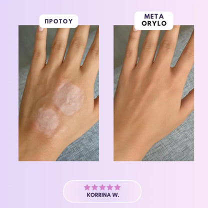 Collagen Scar Tape