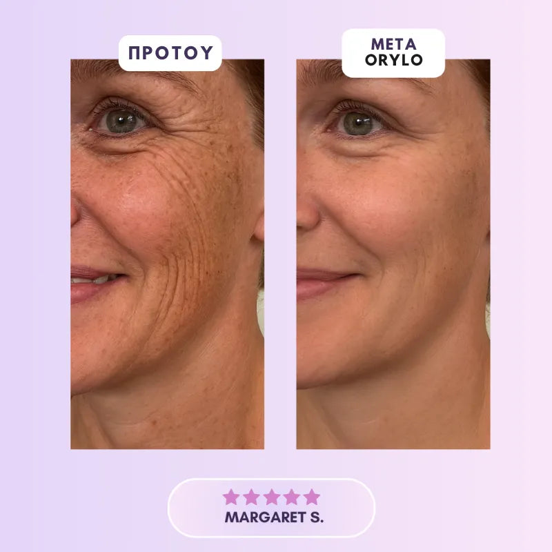 Collagen Scar Tape