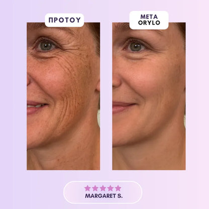 Collagen Scar Tape