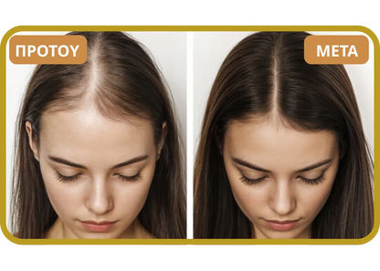 Orylo™ RootBoost Σαμπουάν Αναζωογόνησης Μαλλιών v2 (Women)