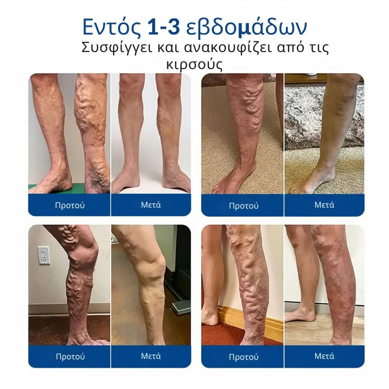 VeinTarget Microneedle Patch