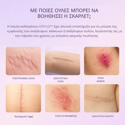 Collagen Scar Tape