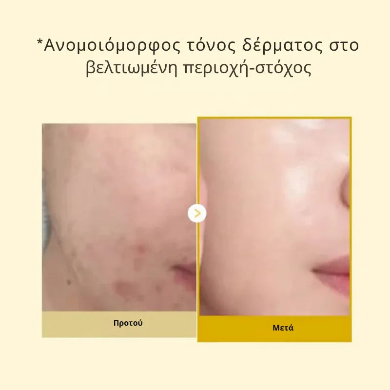 Kojic Acid Turmeric Mask