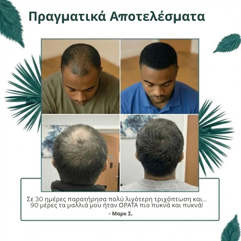 Natural DHT Blocker