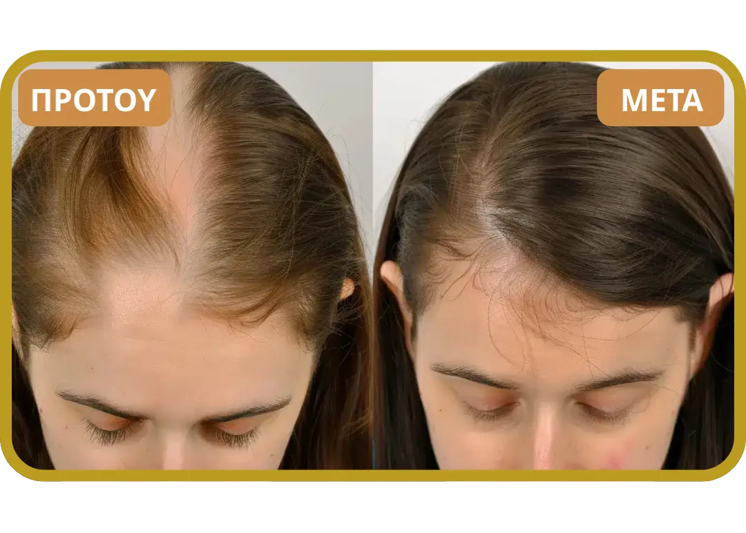 Orylo™ RootBoost Σαμπουάν Αναζωογόνησης Μαλλιών v2 (Women)