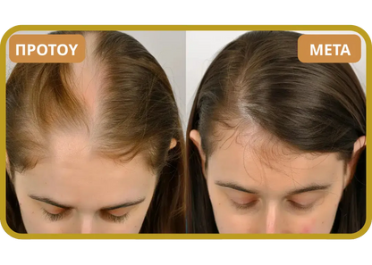 Orylo™ RootBoost Σαμπουάν Αναζωογόνησης Μαλλιών v2 (Women)