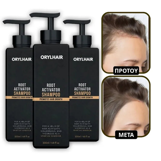 Orylo™ RootBoost Σαμπουάν Αναζωογόνησης Μαλλιών v2 (Women)