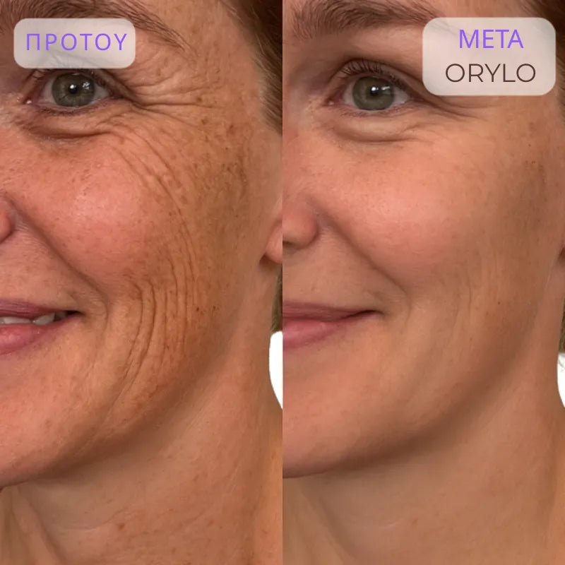 Collagen Scar Tape