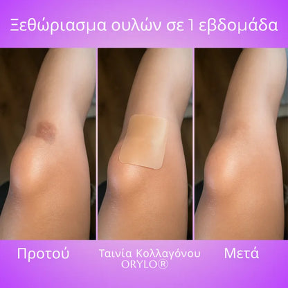 Collagen Scar Tape