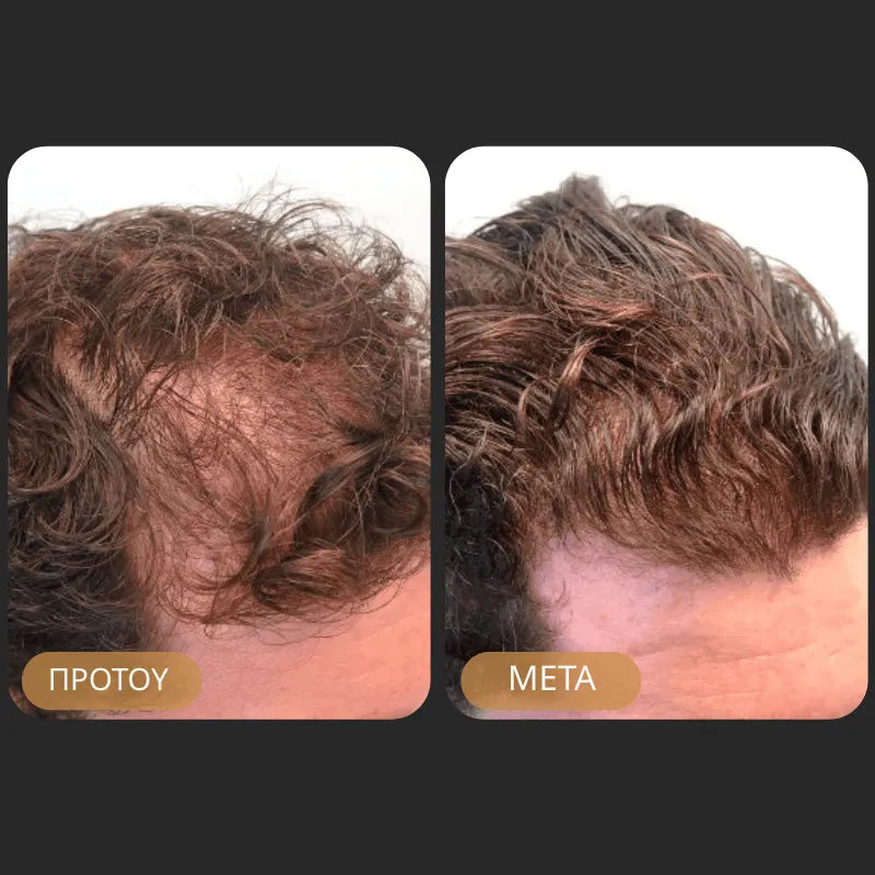 Orylo™ RootBoost Σαμπουάν Αναζωογόνησης Μαλλιών