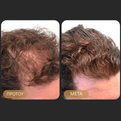 Orylo™ RootBoost Σαμπουάν Αναζωογόνησης Μαλλιών