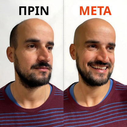 ORYLO | OryloEdge™