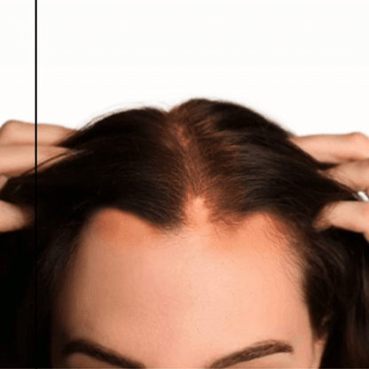 Orylo™ RootBoost Σαμπουάν Αναζωογόνησης Μαλλιών v2 (Women)