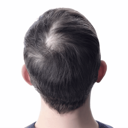 Orylo™ RootBoost Σαμπουάν Αναζωογόνησης Μαλλιών